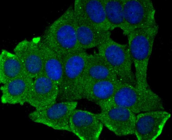 MMP17 Antibody in Immunocytochemistry (ICC/IF)