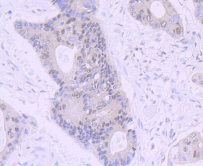 NR1D1 Antibody in Immunohistochemistry (Paraffin) (IHC (P))