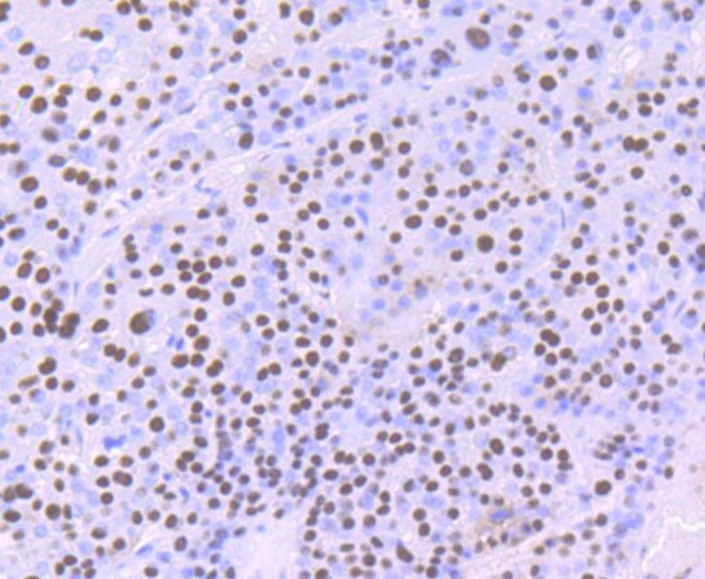 ILF2 Antibody in Immunohistochemistry (Paraffin) (IHC (P))