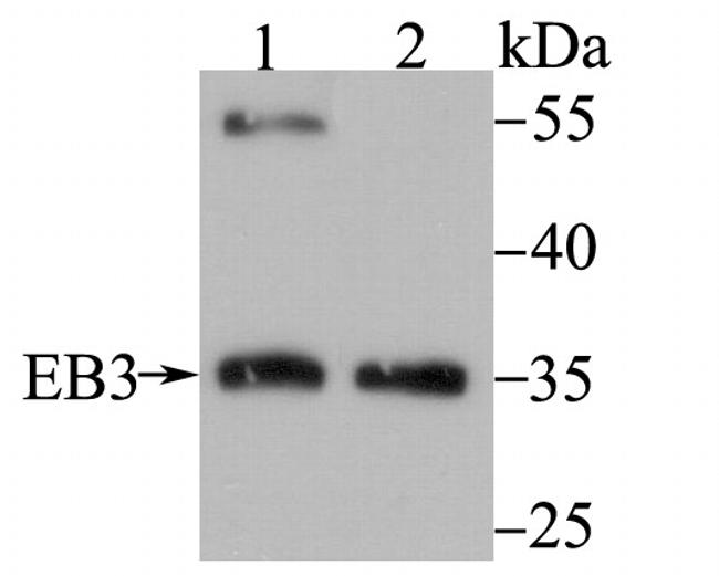 MAPRE3 Antibody in Western Blot (WB)