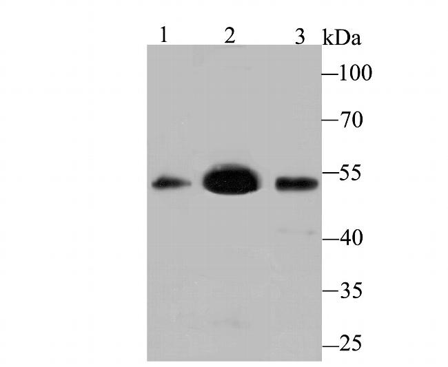 MEIS2 Antibody in Western Blot (WB)