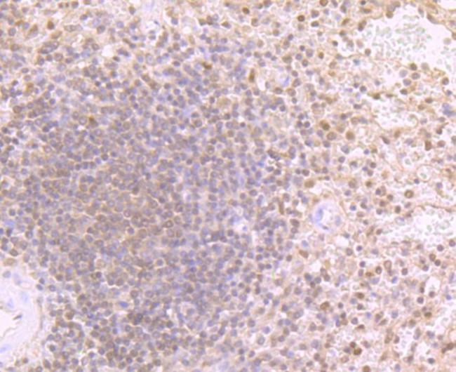 PSMB9 Antibody in Immunohistochemistry (Paraffin) (IHC (P))