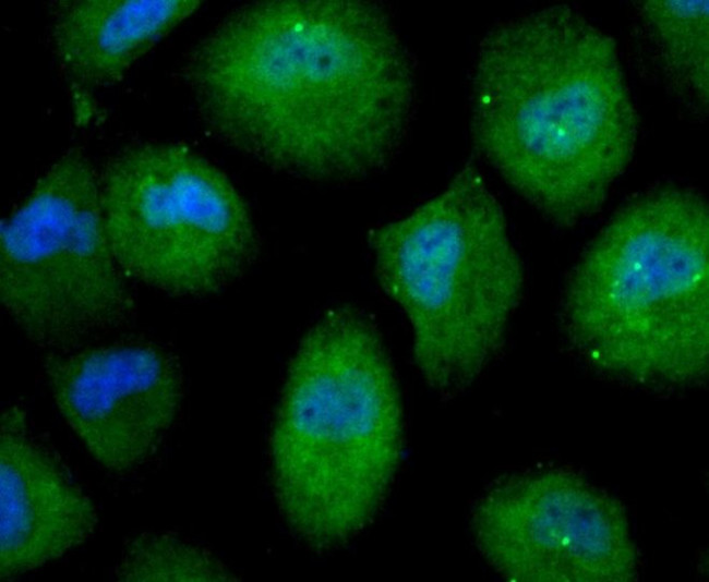 Nesprin 1 Antibody in Immunocytochemistry (ICC/IF)