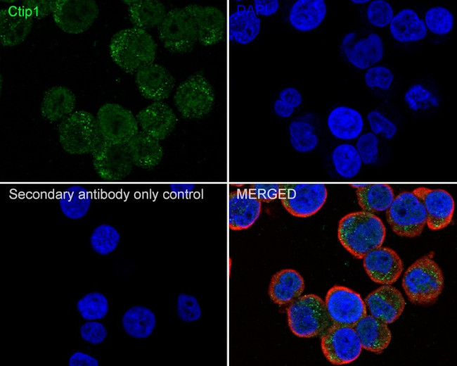 BCL11A Antibody in Immunocytochemistry (ICC/IF)
