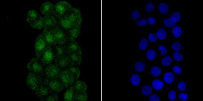 RPA70 Antibody in Immunocytochemistry (ICC/IF)