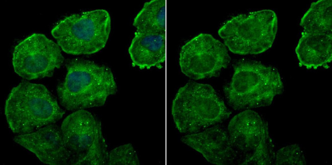 Galectin 7 Antibody in Immunocytochemistry (ICC/IF)