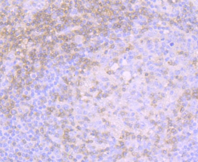 CD3 Antibody in Immunohistochemistry (Paraffin) (IHC (P))