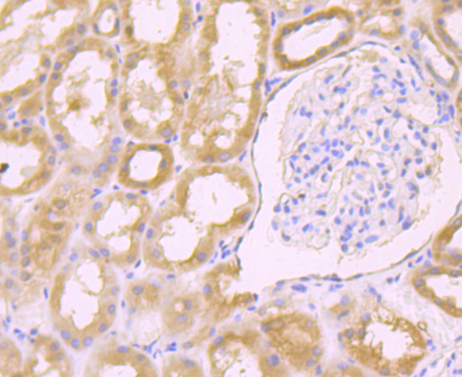 Galectin 8 Antibody in Immunohistochemistry (Paraffin) (IHC (P))