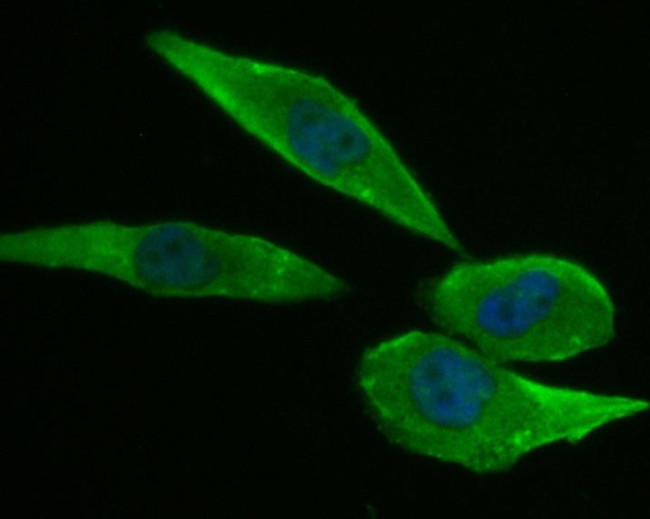 NPC1 Antibody in Immunocytochemistry (ICC/IF)