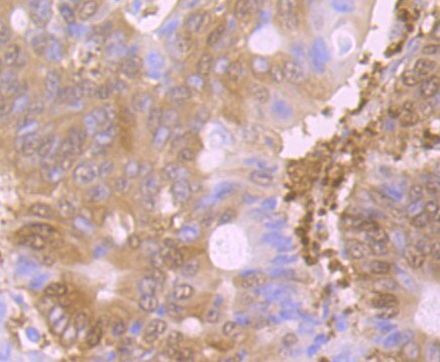 GSS Antibody in Immunohistochemistry (Paraffin) (IHC (P))