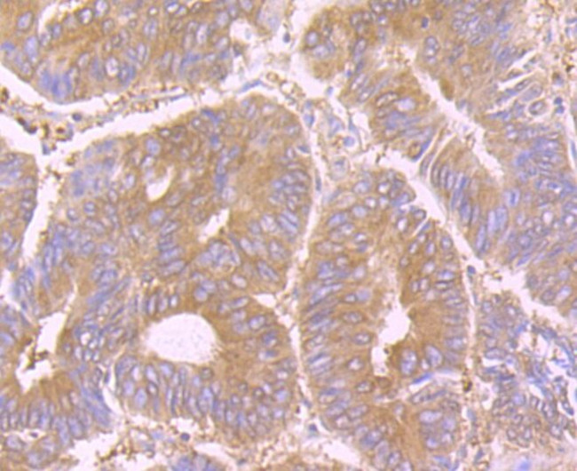 STIP1 Antibody in Immunohistochemistry (Paraffin) (IHC (P))