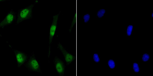 MCM3 Antibody in Immunocytochemistry (ICC/IF)