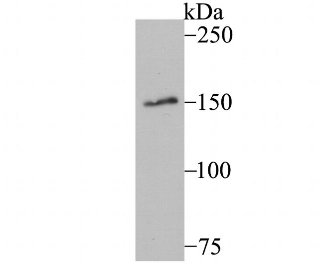 MYBBP1A Antibody in Western Blot (WB)