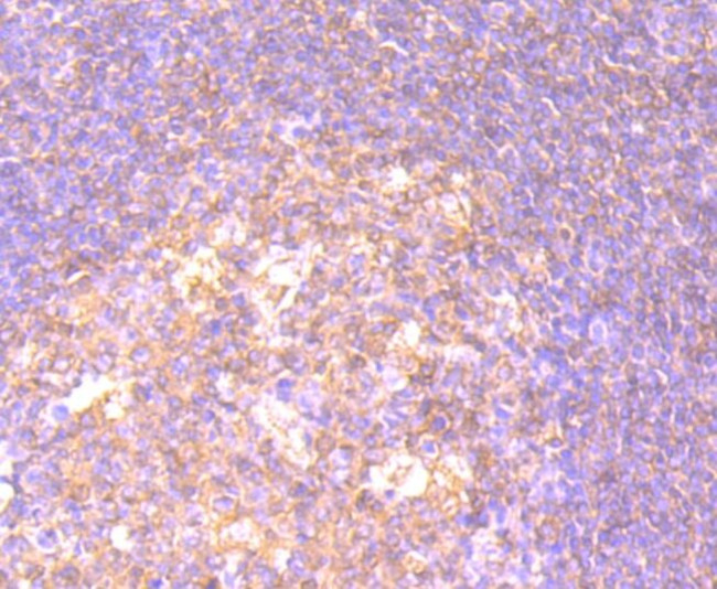 CD27 Antibody in Immunohistochemistry (Paraffin) (IHC (P))
