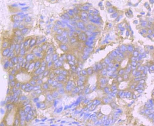 Desmoglein 1 Antibody in Immunohistochemistry (Paraffin) (IHC (P))