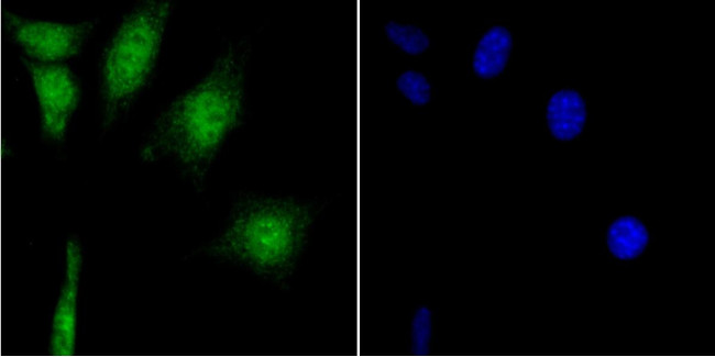 CaMKIV Antibody in Immunocytochemistry (ICC/IF)