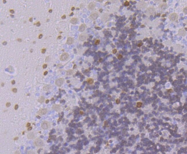 FBXO5 Antibody in Immunohistochemistry (Paraffin) (IHC (P))