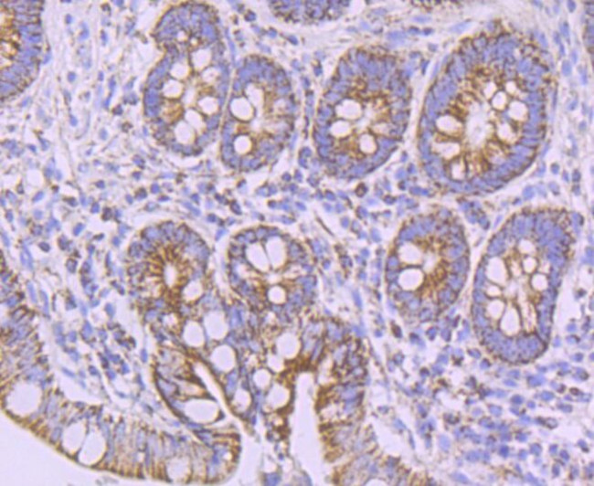 NDUFB8 Antibody in Immunohistochemistry (Paraffin) (IHC (P))