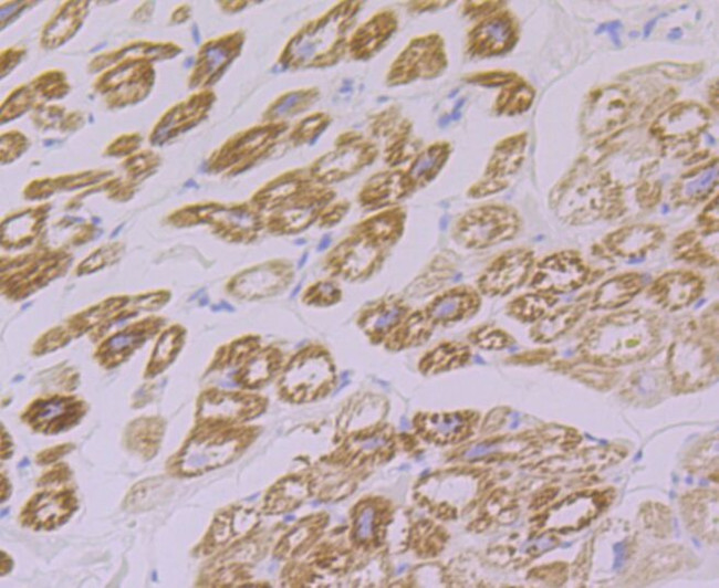 FHL2 Antibody in Immunohistochemistry (Paraffin) (IHC (P))