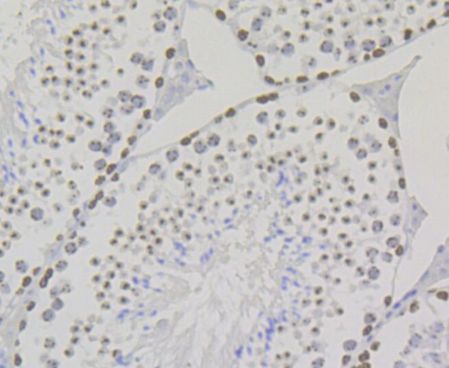 SUV39H2 Antibody in Immunohistochemistry (Paraffin) (IHC (P))
