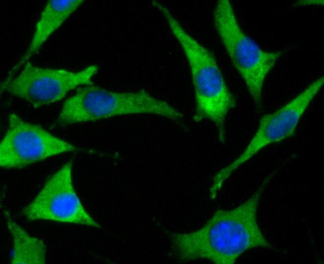 SOCS2 Antibody in Immunocytochemistry (ICC/IF)