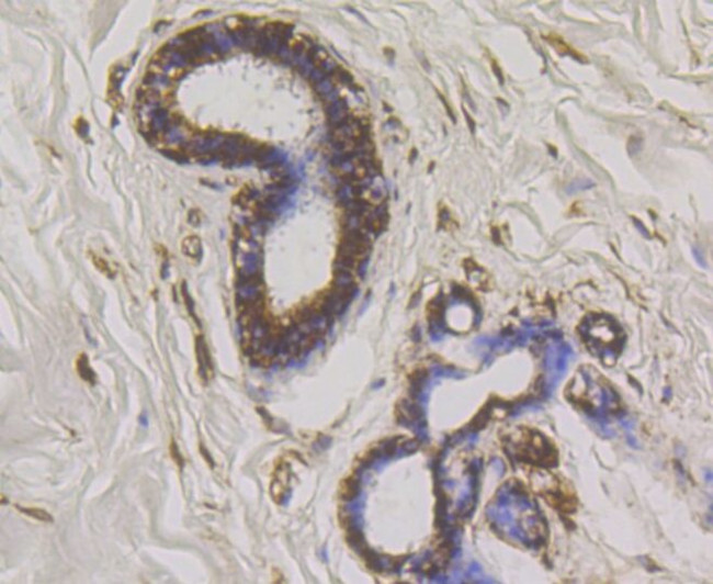 WNK1 Antibody in Immunohistochemistry (Paraffin) (IHC (P))