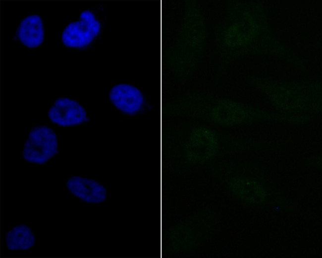 LPIN1 Antibody in Immunocytochemistry (ICC/IF)