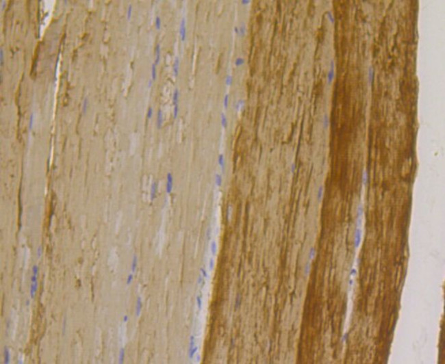 TPM1 Antibody in Immunohistochemistry (Paraffin) (IHC (P))