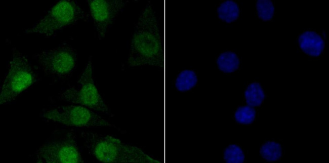 TNPO3 Antibody in Immunocytochemistry (ICC/IF)