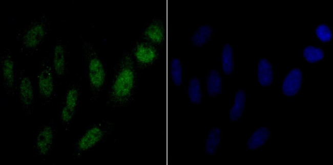 NONO Antibody in Immunocytochemistry (ICC/IF)