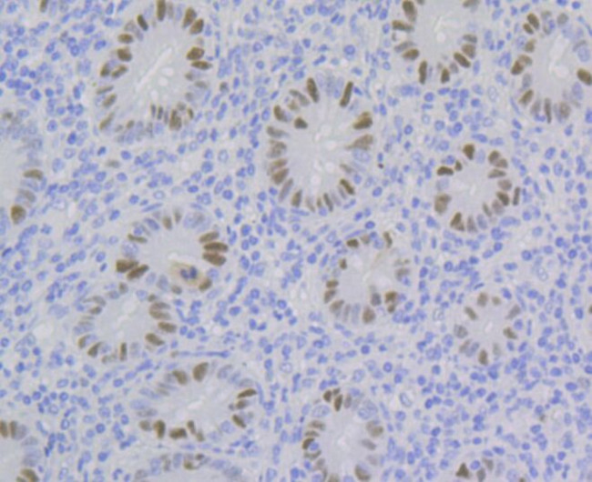 CAF1 p60 Antibody in Immunohistochemistry (Paraffin) (IHC (P))