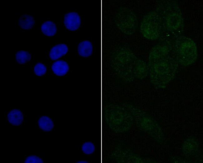 TAP Antibody in Immunocytochemistry (ICC/IF)
