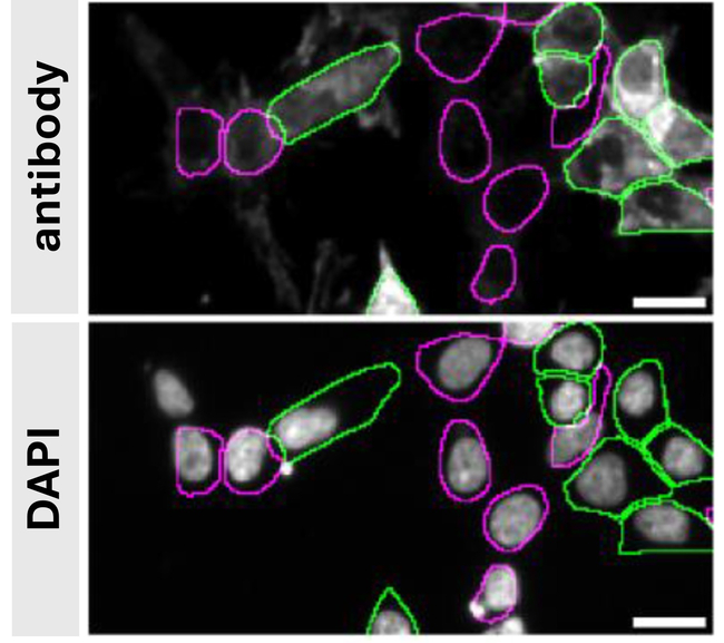 Syntenin 1 Antibody in Immunocytochemistry (ICC/IF)