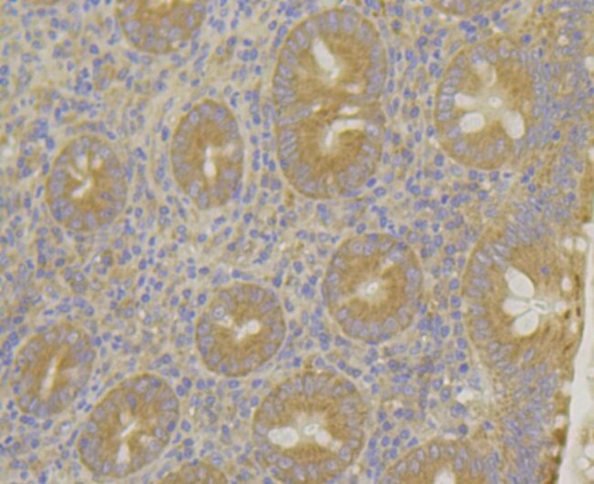 MARK2 Antibody in Immunohistochemistry (Paraffin) (IHC (P))