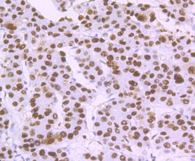 DDB2 Antibody in Immunohistochemistry (Paraffin) (IHC (P))