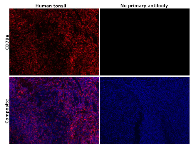 CD79a Antibody in Immunohistochemistry (Paraffin) (IHC (P))