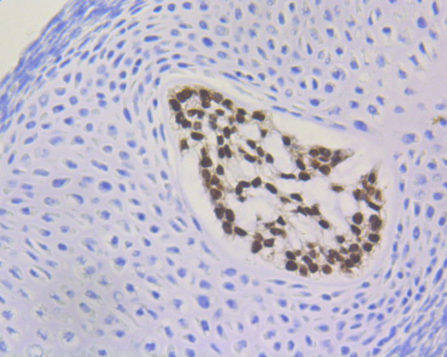 Brachyury Antibody in Immunohistochemistry (Paraffin) (IHC (P))