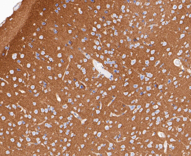 GNB2 Antibody in Immunohistochemistry (Paraffin) (IHC (P))