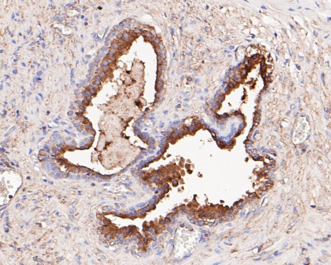 NDUFAF1 Antibody in Immunohistochemistry (Paraffin) (IHC (P))