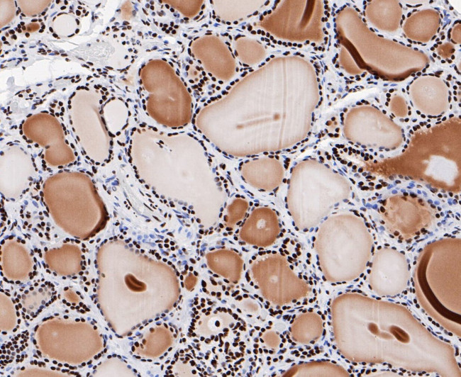 GTPBP4 Antibody in Immunohistochemistry (Paraffin) (IHC (P))