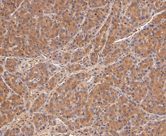 Calpain S1 Antibody in Immunohistochemistry (Paraffin) (IHC (P))