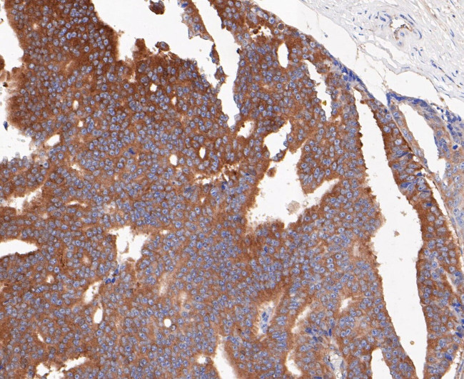 Lactoferrin Antibody in Immunohistochemistry (Paraffin) (IHC (P))