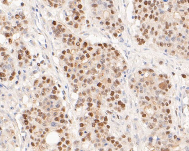 TIMELESS Antibody in Immunohistochemistry (Paraffin) (IHC (P))