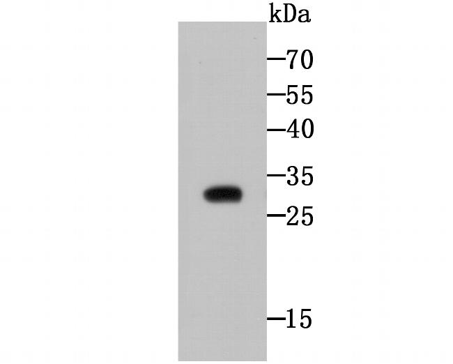 CTHRC1 Antibody in Western Blot (WB)