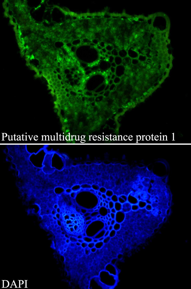 Putative multidrug resistance protein 1 Antibody in Immunohistochemistry (Paraffin) (IHC (P))
