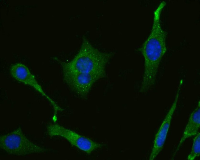 MAOA Antibody in Immunocytochemistry (ICC/IF)