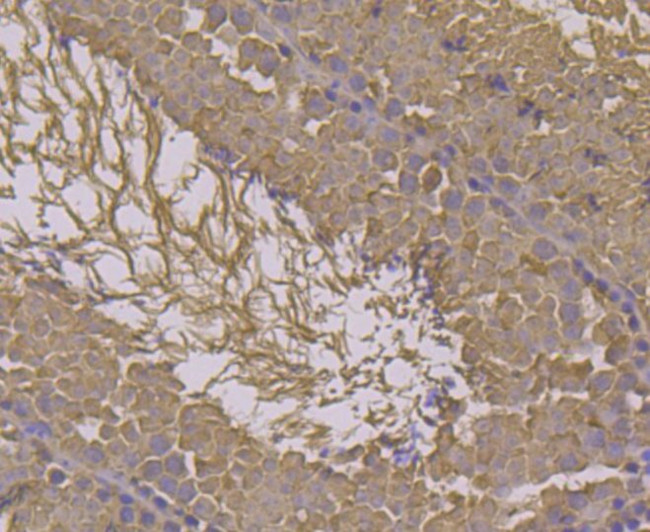 HSP701L Antibody in Immunohistochemistry (Paraffin) (IHC (P))