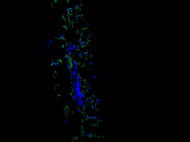 TGG2 Antibody in Immunocytochemistry (ICC/IF)