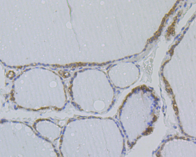NME1 Antibody in Immunohistochemistry (Paraffin) (IHC (P))