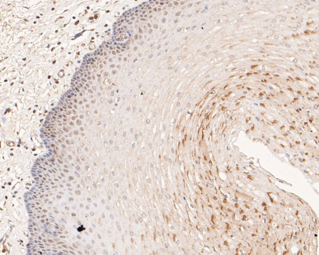 MCM7 Antibody in Immunohistochemistry (Paraffin) (IHC (P))